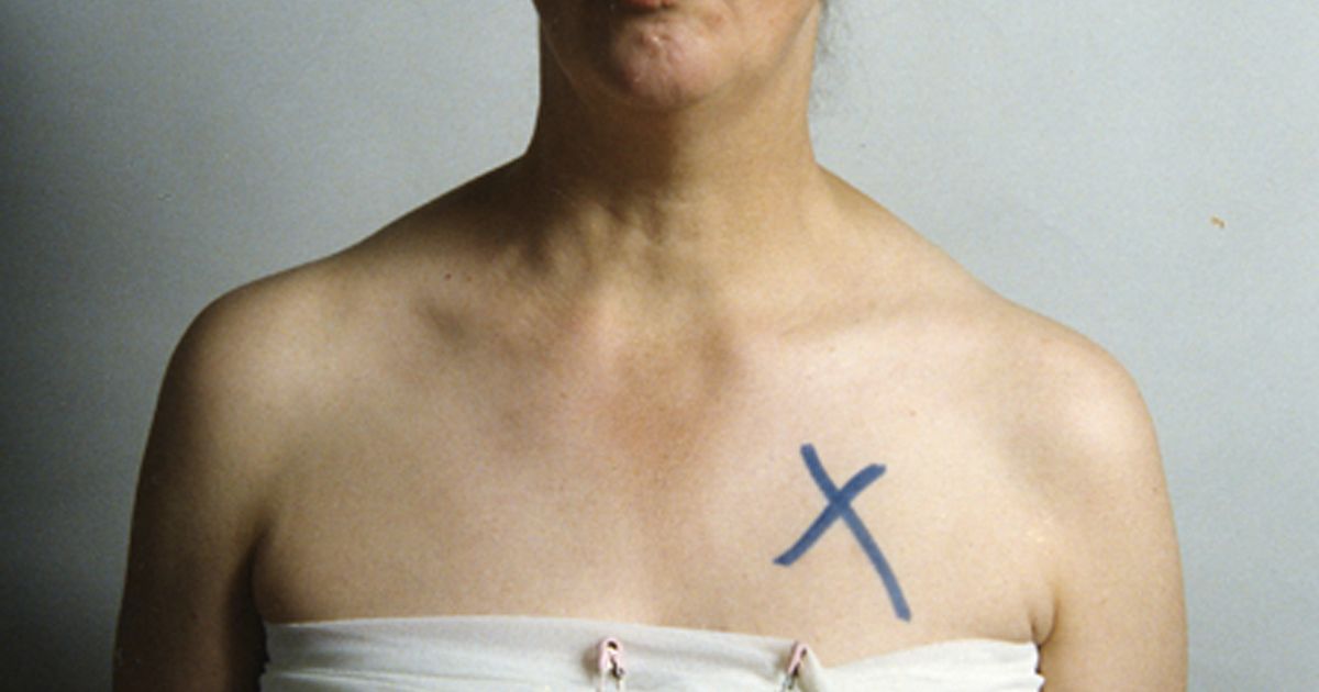 Jo Spence & Oreet Ashery: Misbehaving Bodies - Announcements - e-flux
